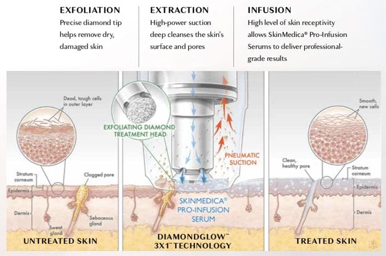 DiamondGlow Technology