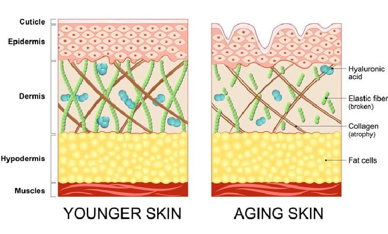 skin diagram