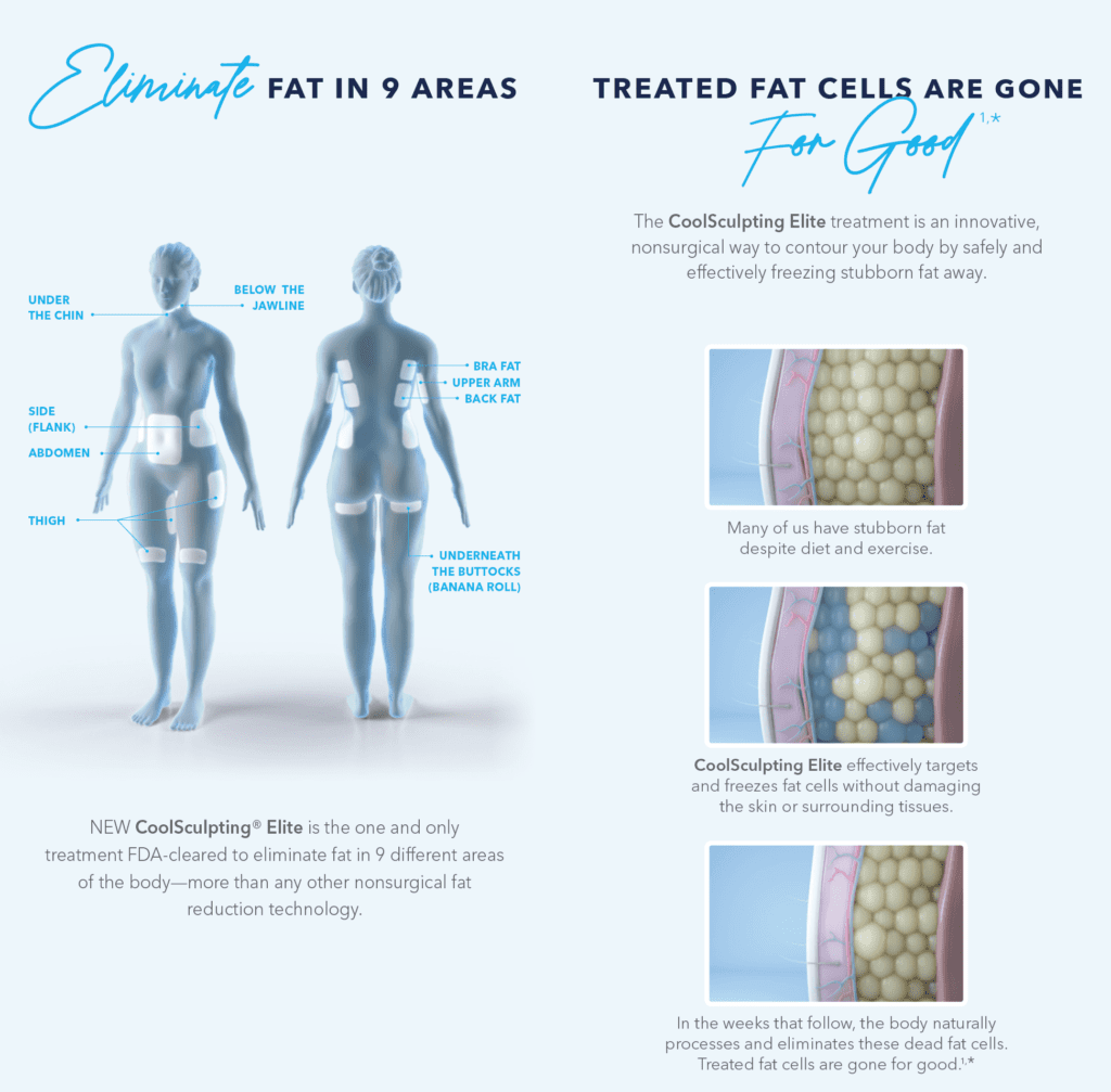 4 Reasons Why CoolSculpting® ELITE is Better than CoolSculpting