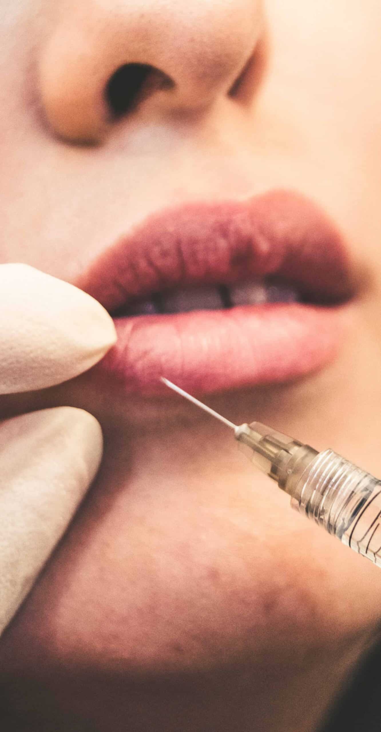 Botox Injections in Burnsville, MN