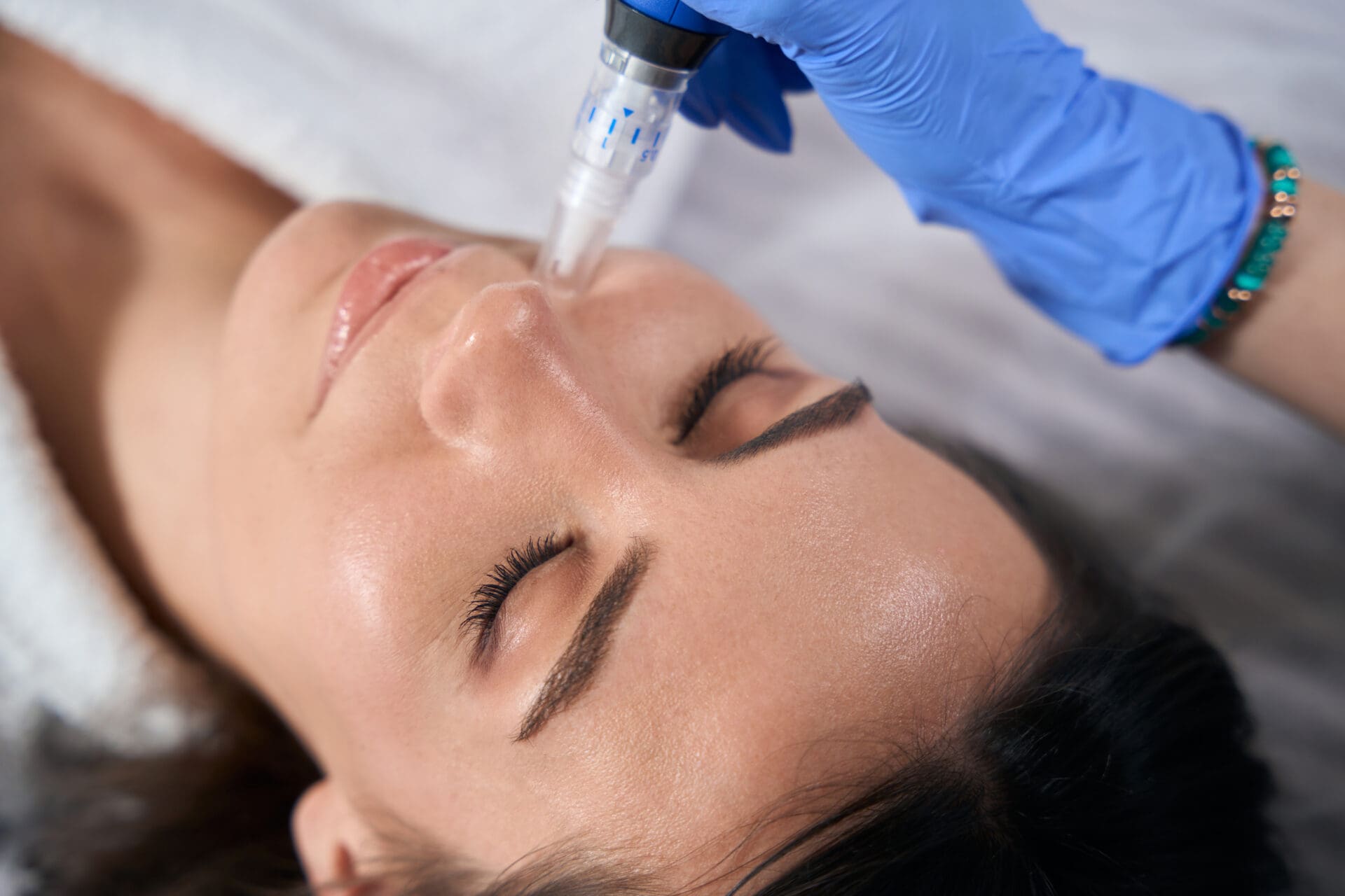 High Precision Microneedling Burnsville & Lakeville, MN